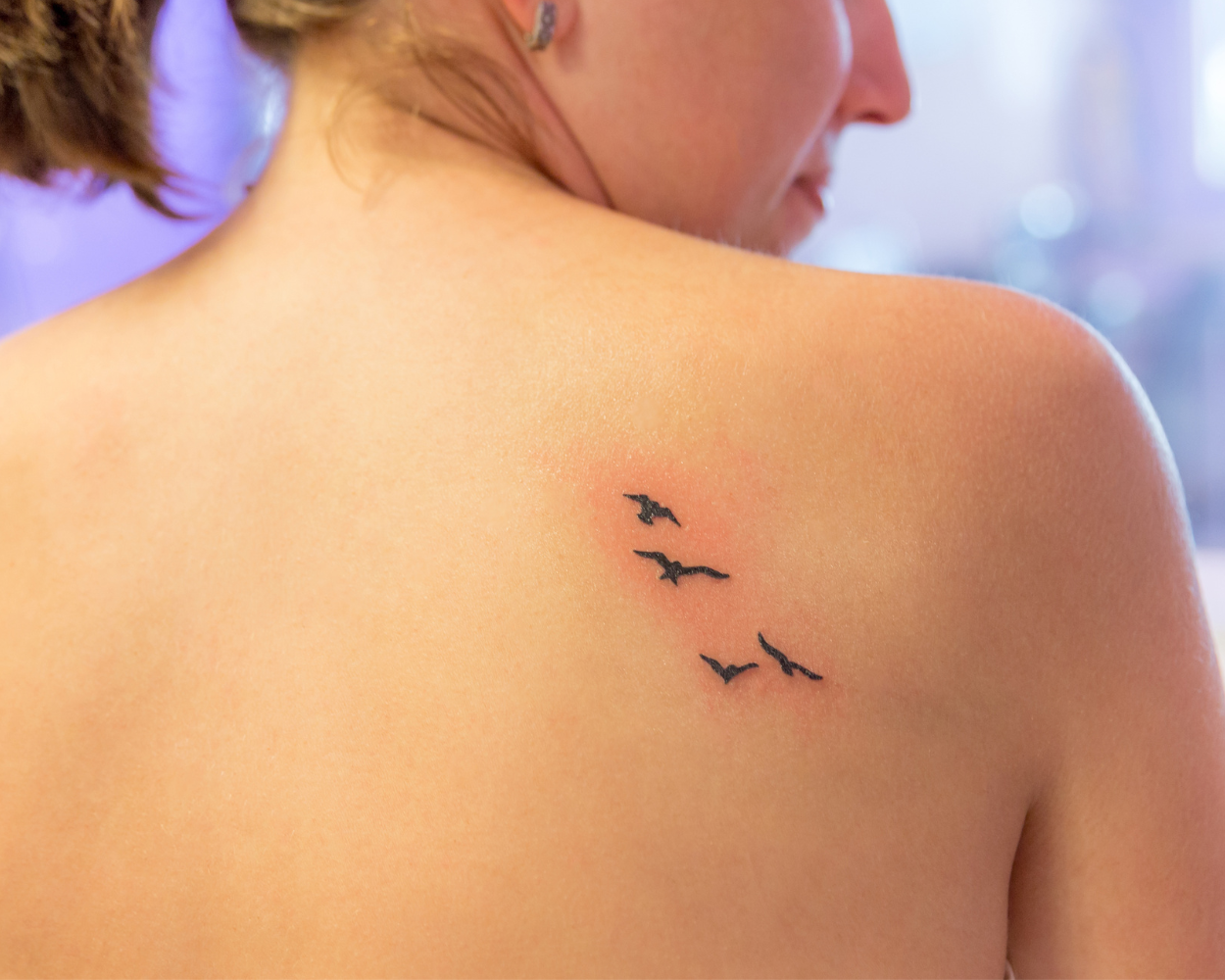 tattoo redness, irritation, acne or reaction